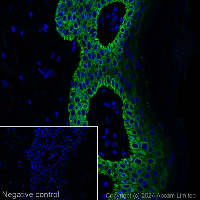 Immunohistochemistry (Formalin/PFA-fixed paraffin-embedded sections) - Alexa Fluor® 488 Anti-Cytokeratin 14 antibody [LL002] (AB320070)