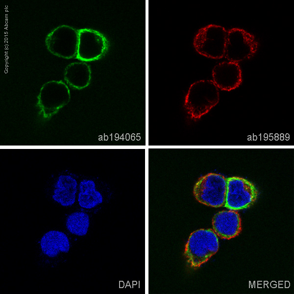 Immunocytochemistry/ Immunofluorescence - Alexa Fluor® 488 Anti-Cytokeratin 15 antibody [EPR1614Y] (AB194065)