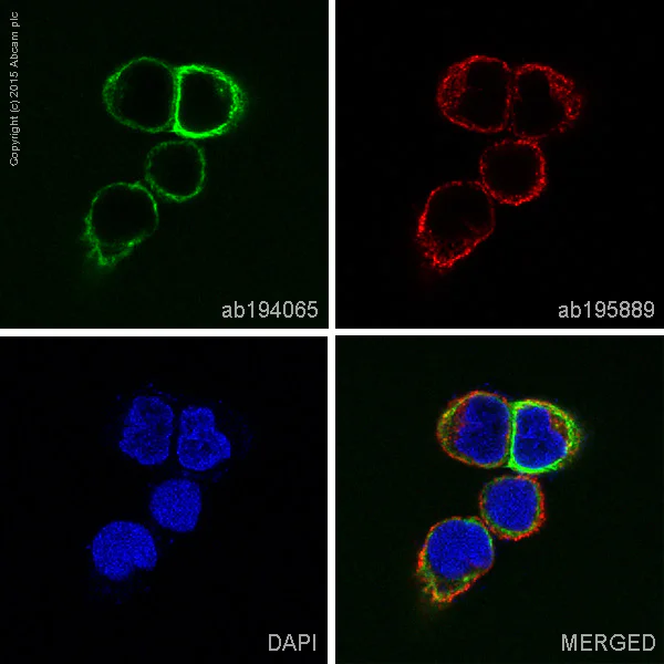 Immunocytochemistry/ Immunofluorescence - Alexa Fluor® 488 Anti-Cytokeratin 15 antibody [EPR1614Y] (AB194065)