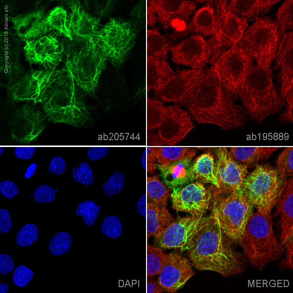 Immunocytochemistry/ Immunofluorescence - Alexa Fluor® 488 Anti-Cytokeratin 16/K16 antibody [EP1615Y] (AB205744)