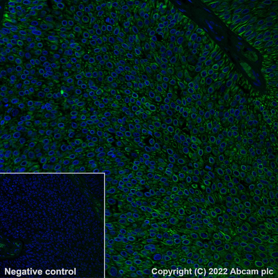 Alexa Fluor® 488 Anti-Cytokeratin 17 抗体 [EP1623] - Cytoskeleton