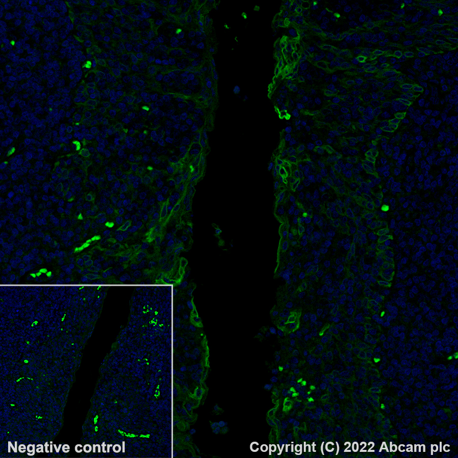 Immunohistochemistry (Formalin/PFA-fixed paraffin-embedded sections) - Alexa Fluor® 488 Anti-Cytokeratin 17 antibody [EP1623] - Cytoskeleton Marker (AB185032)
