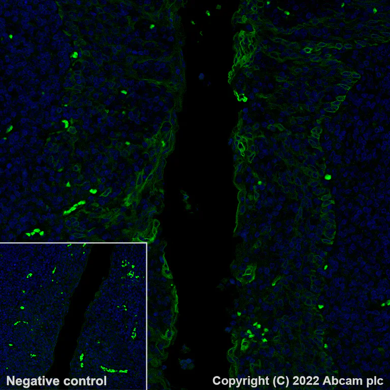 Immunohistochemistry (Formalin/PFA-fixed paraffin-embedded sections) - Alexa Fluor® 488 Anti-Cytokeratin 17 antibody [EP1623] - Cytoskeleton Marker (AB185032)