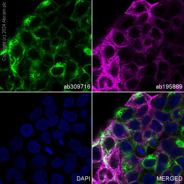 Immunocytochemistry/ Immunofluorescence - Alexa Fluor® 488 Anti-Cytokeratin 17 antibody [EPR1624Y] (AB309716)
