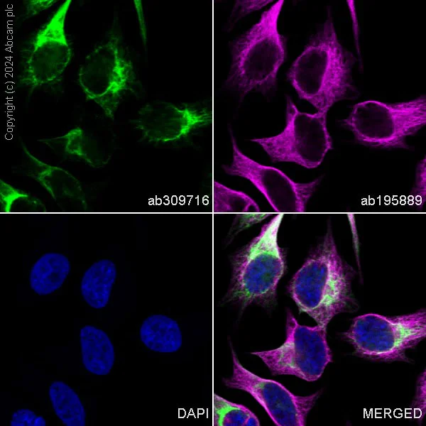 Immunocytochemistry/ Immunofluorescence - Alexa Fluor® 488 Anti-Cytokeratin 17 antibody [EPR1624Y] (AB309716)