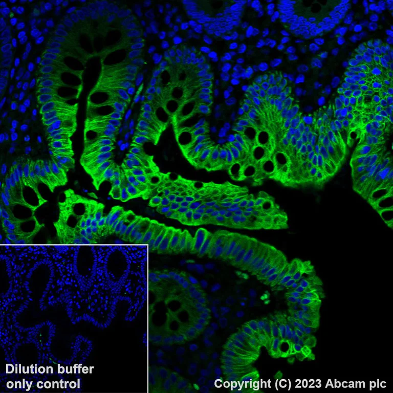 Immunohistochemistry (Formalin/PFA-fixed paraffin-embedded sections) - Alexa Fluor® 488 Anti-Cytokeratin 17 antibody [EPR1624Y] (AB309716)