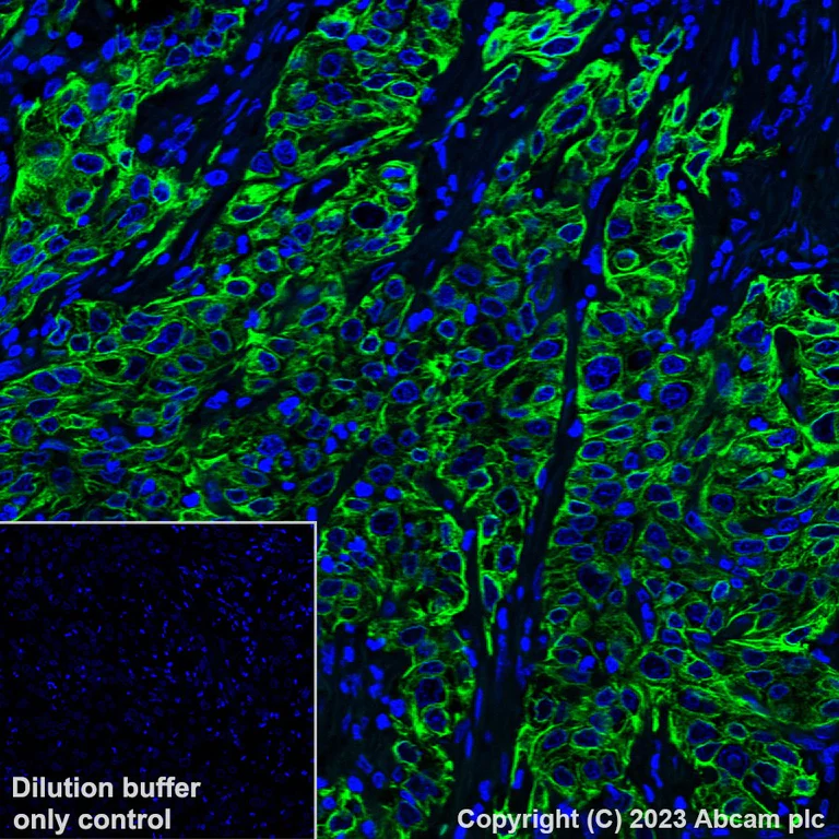 Immunohistochemistry (Formalin/PFA-fixed paraffin-embedded sections) - Alexa Fluor® 488 Anti-Cytokeratin 17 antibody [EPR1624Y] (AB309716)