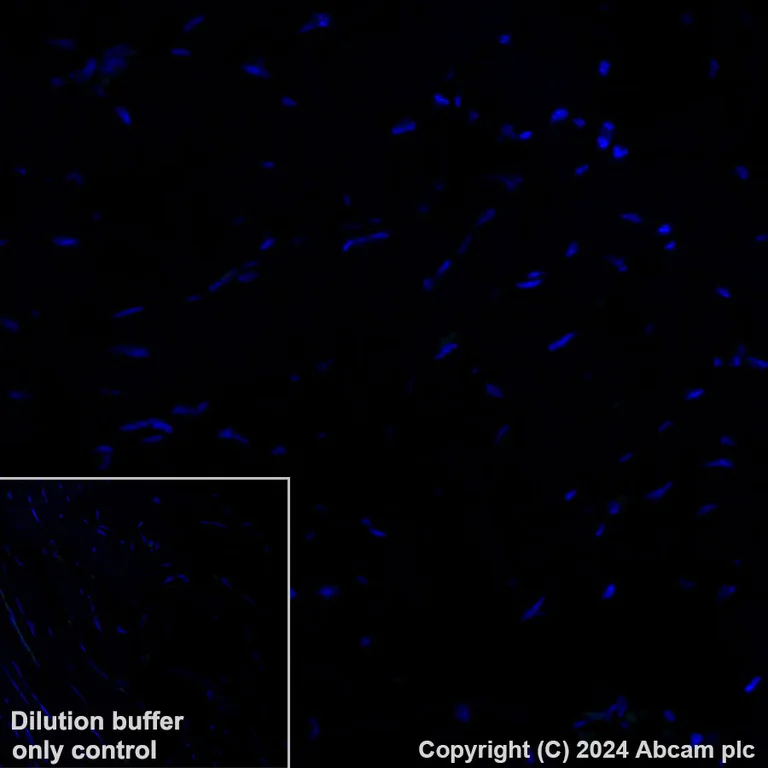Immunohistochemistry (Formalin/PFA-fixed paraffin-embedded sections) - Alexa Fluor® 488 Anti-Cytokeratin 17 antibody [EPR1624Y] (AB309716)