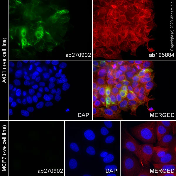 Immunocytochemistry/ Immunofluorescence - Alexa Fluor® 488 Anti-Cytokeratin 17 antibody [SP95] (AB270902)