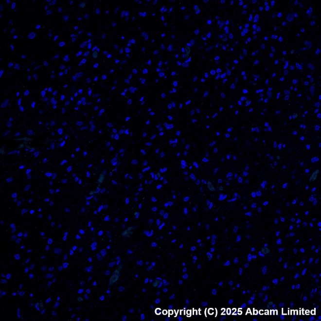 Alexa Fluor® 488 conjugated Anti-Cytokeratin 19 antibody [EP1580Y