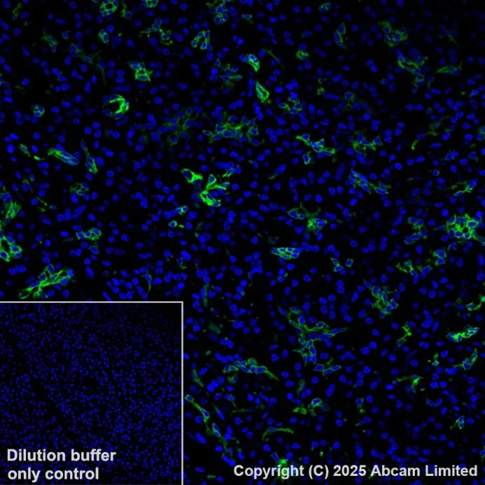 Immunohistochemistry (Formalin/PFA-fixed paraffin-embedded sections) - Alexa Fluor® 488 Anti-Cytokeratin 19 antibody [EPR1579Y] (AB205445)