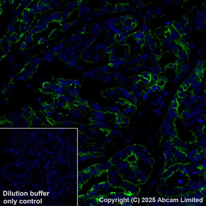 Immunohistochemistry (Formalin/PFA-fixed paraffin-embedded sections) - Alexa Fluor® 488 Anti-Cytokeratin 19 antibody [EPR1579Y] (AB205445)
