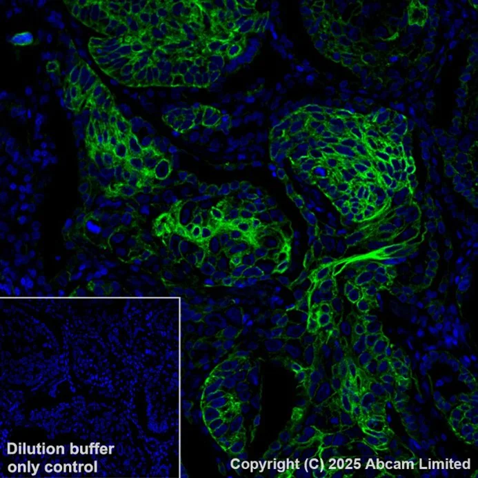 Immunohistochemistry (Formalin/PFA-fixed paraffin-embedded sections) - Alexa Fluor® 488 Anti-Cytokeratin 19 antibody [EPR1579Y] (AB205445)