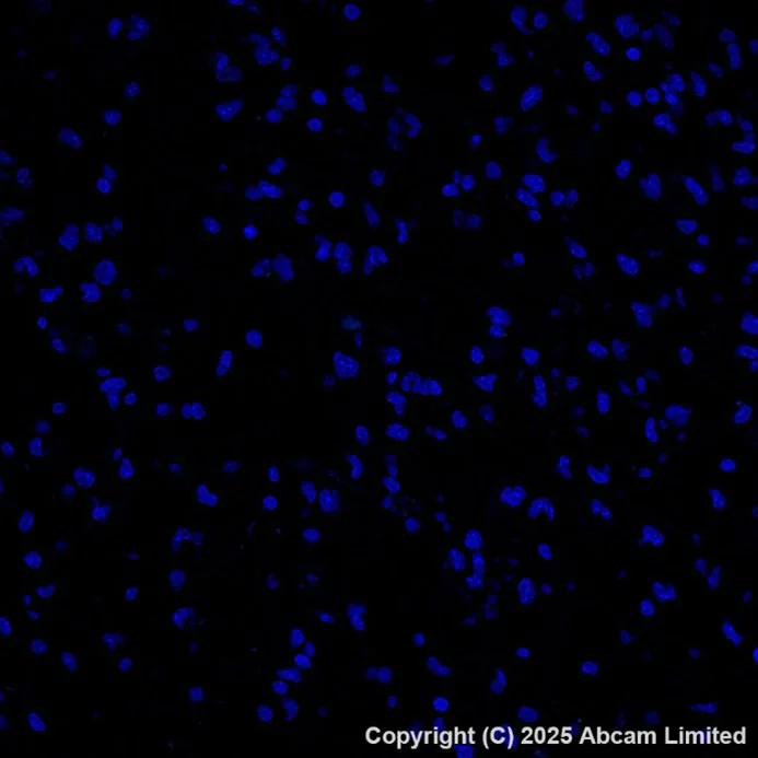 Immunohistochemistry (Formalin/PFA-fixed paraffin-embedded sections) - Alexa Fluor® 488 Anti-Cytokeratin 19 antibody [EPR1579Y] (AB205445)