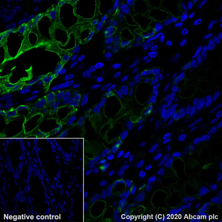 Immunohistochemistry (Formalin/PFA-fixed paraffin-embedded sections) - Alexa Fluor® 488 Anti-Cytokeratin 20 antibody [EPR1622Y] (AB275988)