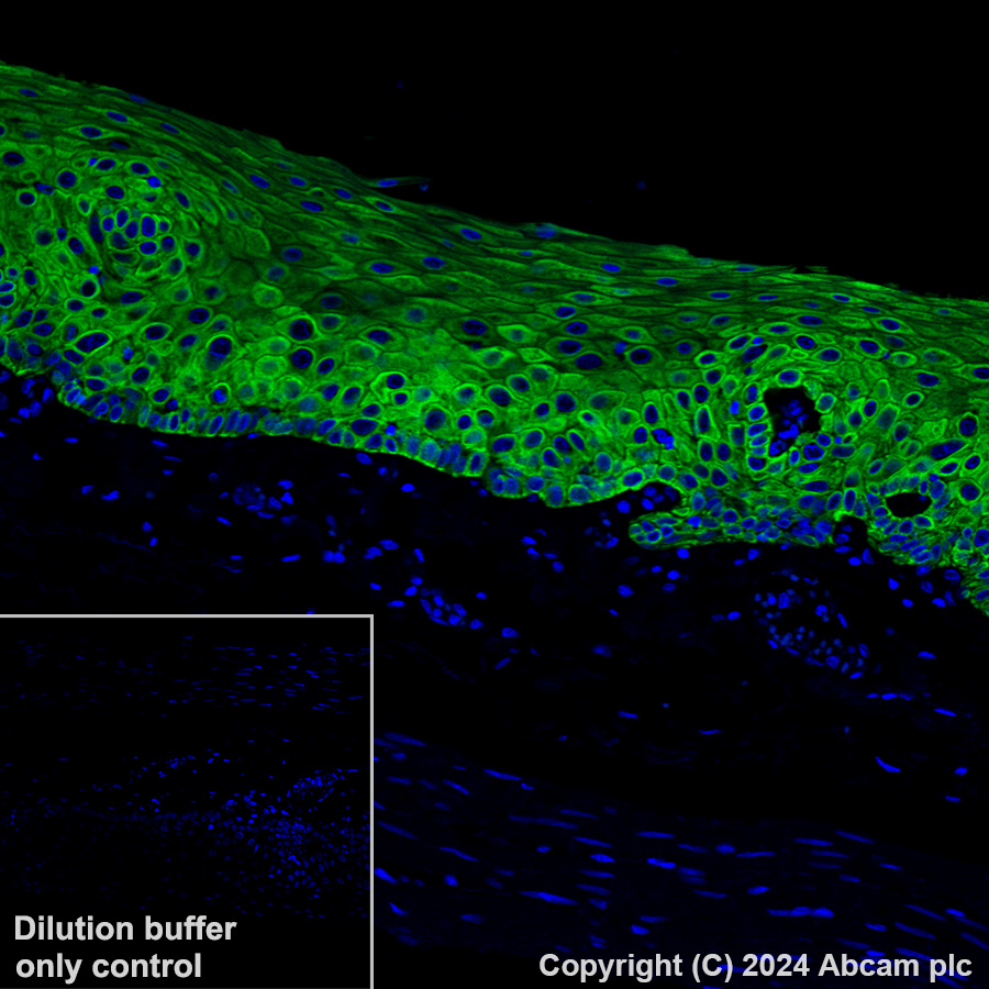 cyanosis様 alexa-fluor-488-cytokeratin-5-