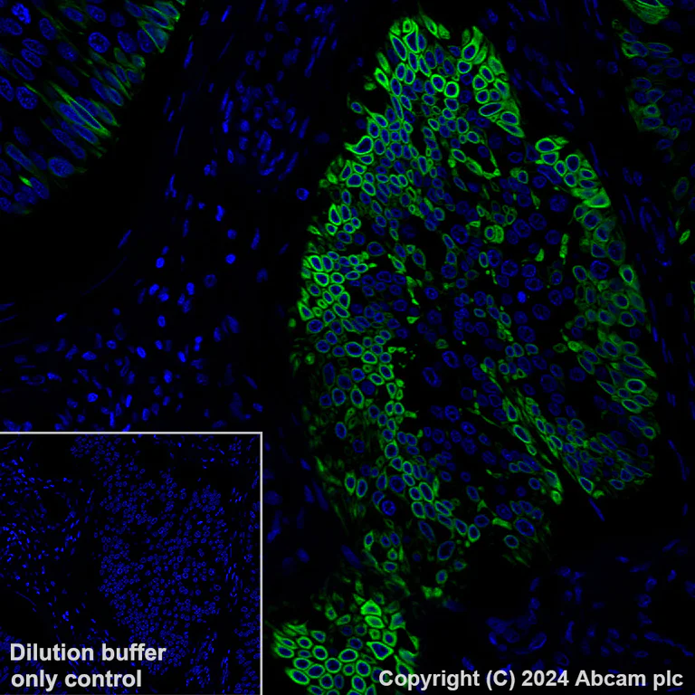 Alexa Fluor® 488 conjugated Anti-Cytokeratin 5 antibody [EP1601Y ...