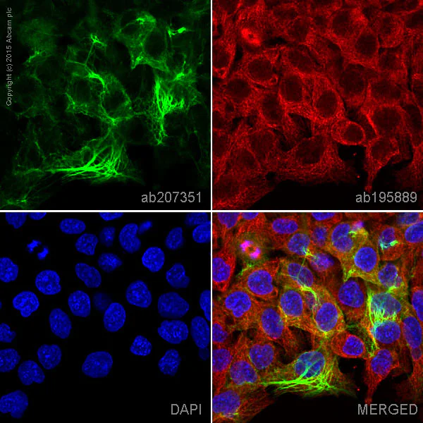 Immunocytochemistry/ Immunofluorescence - Alexa Fluor® 488 Anti-Cytokeratin 5 antibody [EPR1600Y] (AB207351)