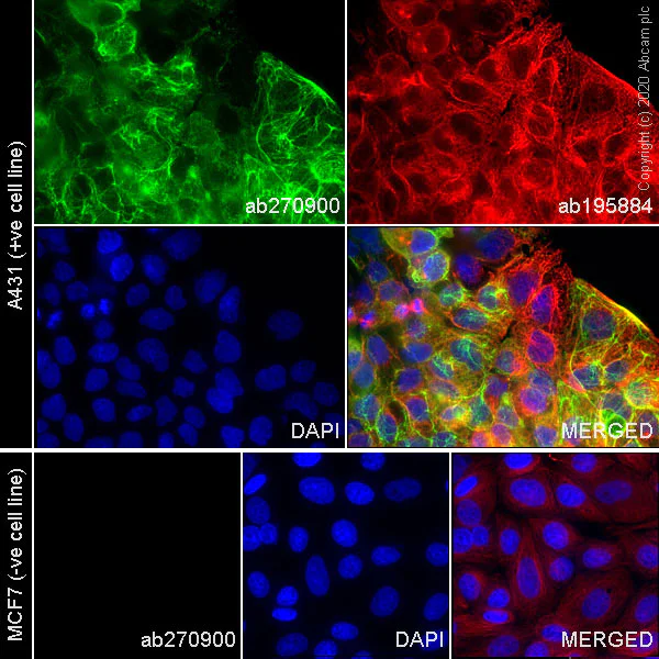 Immunocytochemistry - Alexa Fluor® 488 Anti-Cytokeratin 5 antibody [SP27] (AB270900)