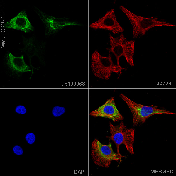 Immunocytochemistry/ Immunofluorescence - Alexa Fluor® 488 Anti-Cytokeratin 6 antibody [EPR1602Y] (AB199068)