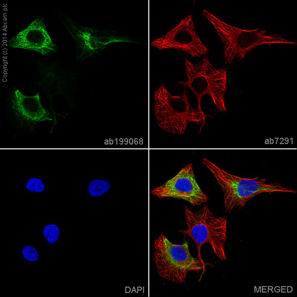 Immunocytochemistry/ Immunofluorescence - Alexa Fluor® 488 Anti-Cytokeratin 6 antibody [EPR1602Y] (AB199068)