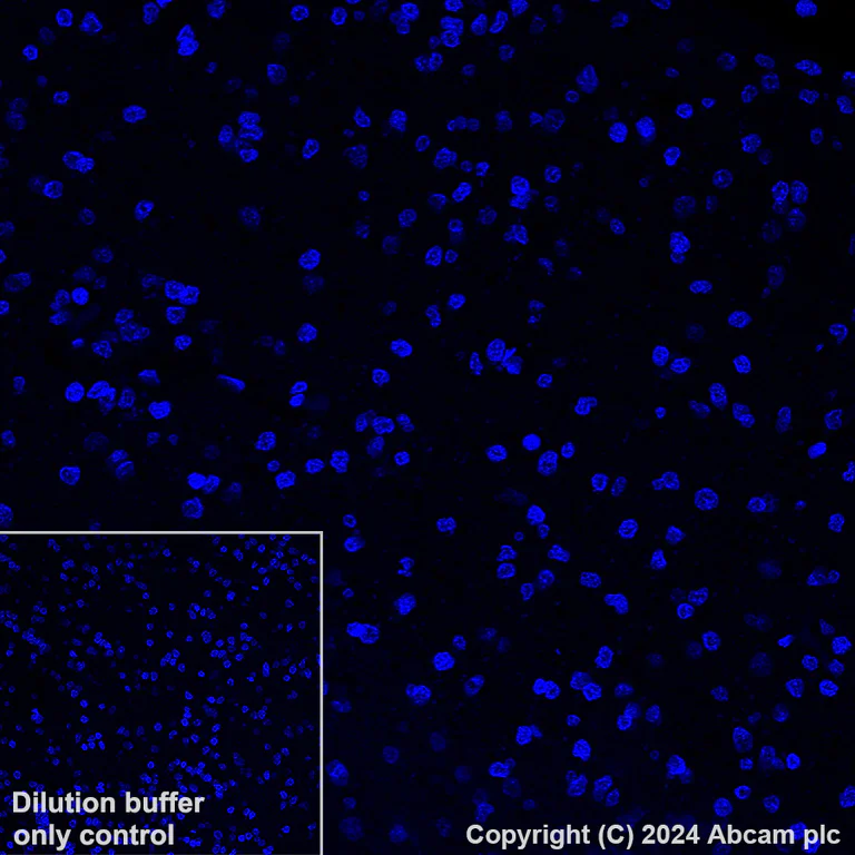 Immunohistochemistry (Formalin/PFA-fixed paraffin-embedded sections) - Alexa Fluor® 488 Anti-Cytokeratin 6 antibody [EPR1602Y] (AB199068)