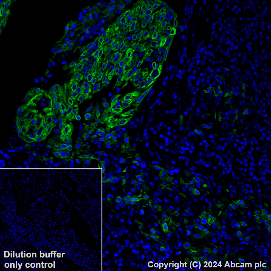 Immunohistochemistry (Formalin/PFA-fixed paraffin-embedded sections) - Alexa Fluor® 488 Anti-Cytokeratin 6 antibody [EPR1602Y] (AB199068)