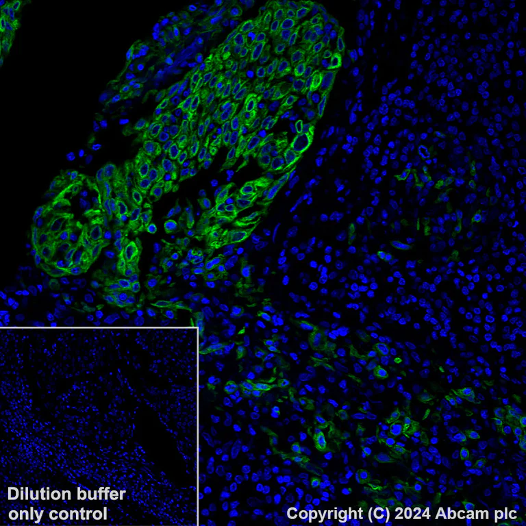 Immunohistochemistry (Formalin/PFA-fixed paraffin-embedded sections) - Alexa Fluor® 488 Anti-Cytokeratin 6 antibody [EPR1602Y] (AB199068)