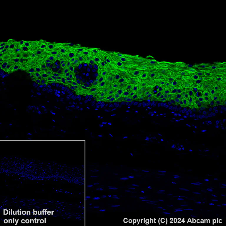 Immunohistochemistry (Formalin/PFA-fixed paraffin-embedded sections) - Alexa Fluor® 488 Anti-Cytokeratin 6 antibody [EPR1602Y] (AB199068)