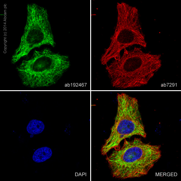 Immunocytochemistry - Alexa Fluor® 488 Anti-Cytokeratin 8 antibody [EP1628Y] (AB192467), expandable thumbnail