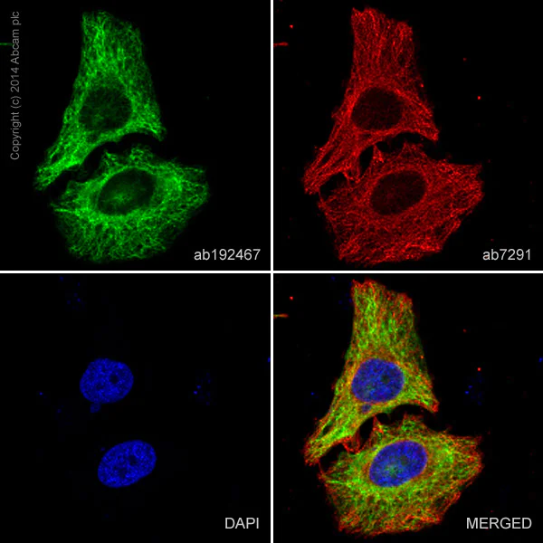 おまとめ【fl482】【q466】【cel1】 Alexa Fluor® 488 conjugated Anti-Cytokeratin 8 antibody