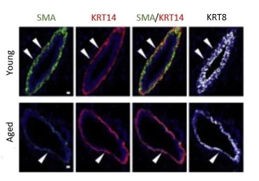 Alexa Fluor® 488 conjugated Anti-Cytokeratin 8 antibody [EP1628Y