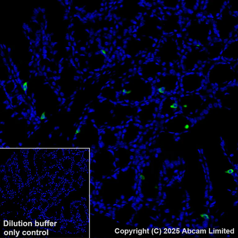 Immunohistochemistry (Formalin/PFA-fixed paraffin-embedded sections) - Alexa Fluor® 488 Anti-DCAMKL1 antibody [EPR6085] (AB202754)