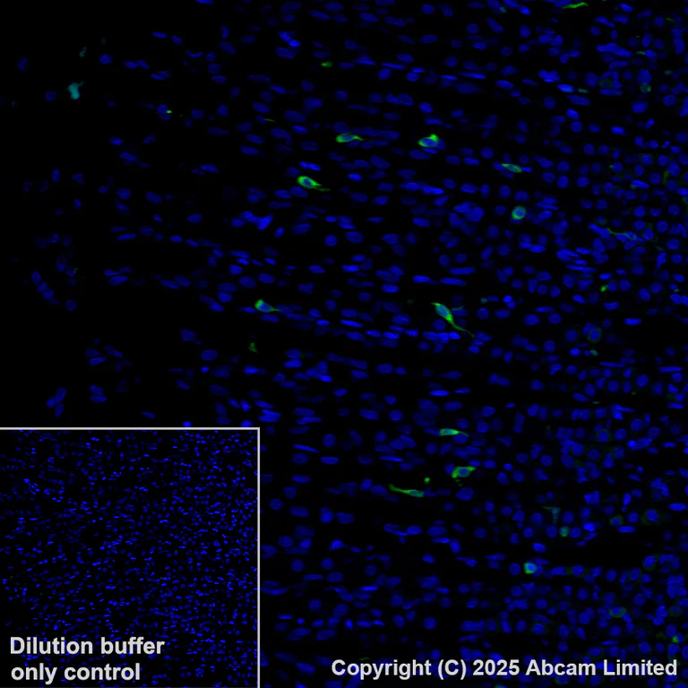 Immunohistochemistry (Formalin/PFA-fixed paraffin-embedded sections) - Alexa Fluor® 488 Anti-DCAMKL1 antibody [EPR6085] (AB202754)
