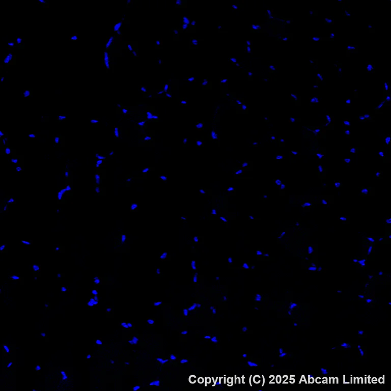 Immunohistochemistry (Formalin/PFA-fixed paraffin-embedded sections) - Alexa Fluor® 488 Anti-DCAMKL1 antibody [EPR6085] (AB202754)