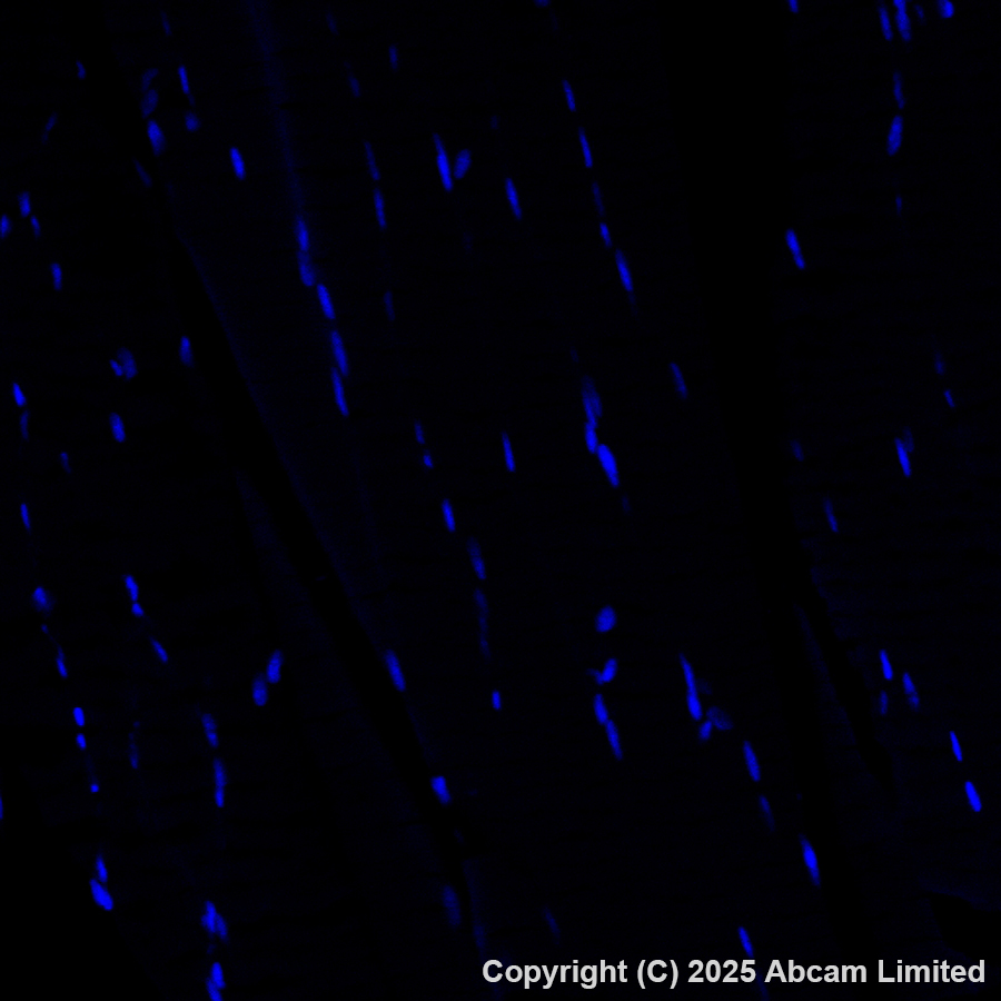 Immunohistochemistry (Formalin/PFA-fixed paraffin-embedded sections) - Alexa Fluor® 488 Anti-DCAMKL1 antibody [EPR6085] (AB202754)