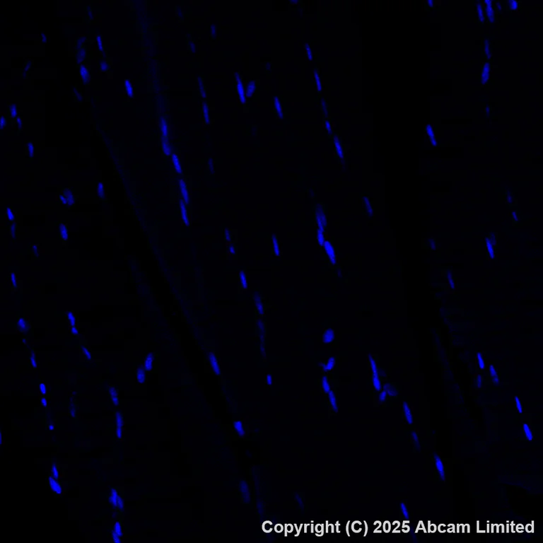 Immunohistochemistry (Formalin/PFA-fixed paraffin-embedded sections) - Alexa Fluor® 488 Anti-DCAMKL1 antibody [EPR6085] (AB202754)