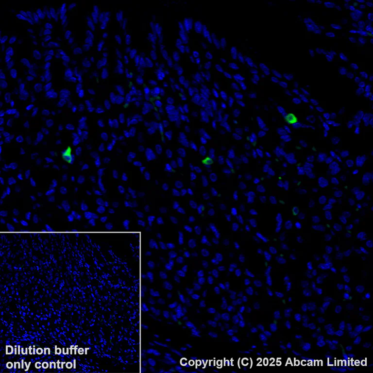 Immunohistochemistry (Formalin/PFA-fixed paraffin-embedded sections) - Alexa Fluor® 488 Anti-DCAMKL1 antibody [EPR6085] (AB202754)