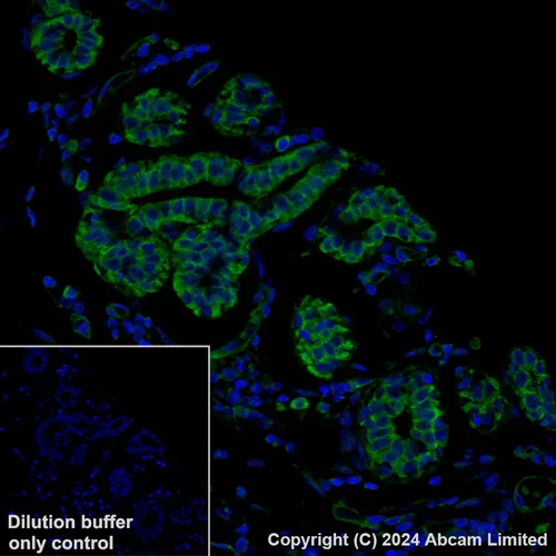 Immunohistochemistry (Formalin/PFA-fixed paraffin-embedded sections) - Alexa Fluor® 488 Anti-Desmoglein 2/DSG2 antibody [EPR6768] (AB322421)