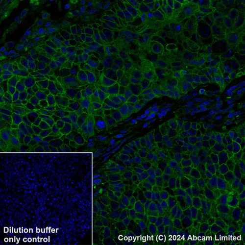 Immunohistochemistry (Formalin/PFA-fixed paraffin-embedded sections) - Alexa Fluor® 488 Anti-Desmoglein 2/DSG2 antibody [EPR6768] (AB322421)