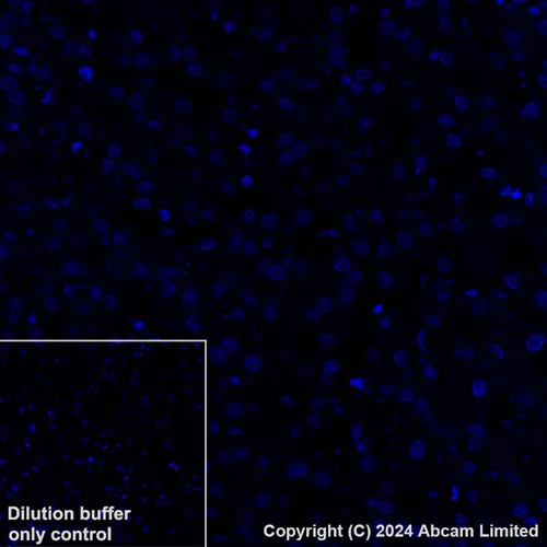 Immunohistochemistry (Formalin/PFA-fixed paraffin-embedded sections) - Alexa Fluor® 488 Anti-Desmoglein 2/DSG2 antibody [EPR6768] (AB322421)