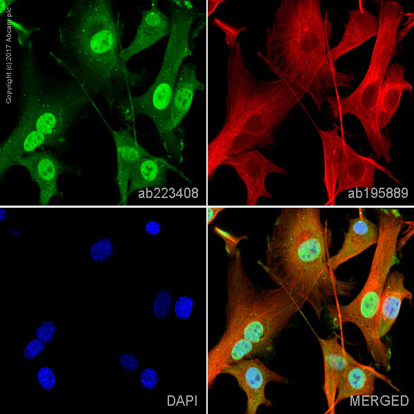 Immunocytochemistry/ Immunofluorescence - Alexa Fluor® 488 Anti-Dlx5 antibody [EPR4488] (AB223408)