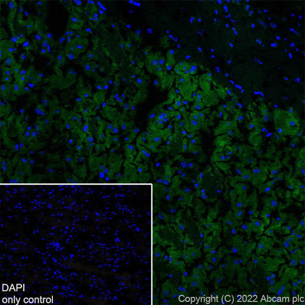 Immunohistochemistry (Frozen sections) - Alexa Fluor® 488 Anti-Dopamine Transporter antibody [EPR19695] (AB302652), expandable thumbnail