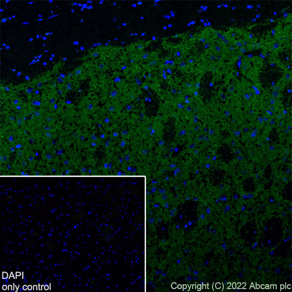 Immunohistochemistry (Frozen sections) - Alexa Fluor® 488 Anti-Dopamine Transporter antibody [EPR19695] (AB302652), expandable thumbnail