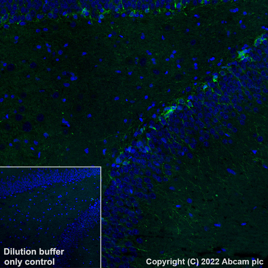 Immunohistochemistry (Formalin/PFA-fixed paraffin-embedded sections) - Alexa Fluor® 488 Anti-Doublecortin antibody [EPR19997] (AB305266), expandable thumbnail