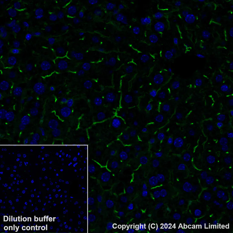 Immunohistochemistry (Formalin/PFA-fixed paraffin-embedded sections) - Alexa Fluor® 488 Anti-DPP4 antibody [EPR18215] (AB322423)