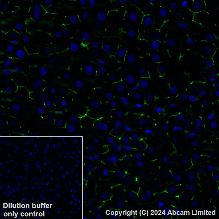 Immunohistochemistry (Formalin/PFA-fixed paraffin-embedded sections) - Alexa Fluor® 488 Anti-DPP4 antibody [EPR18215] (AB322423)