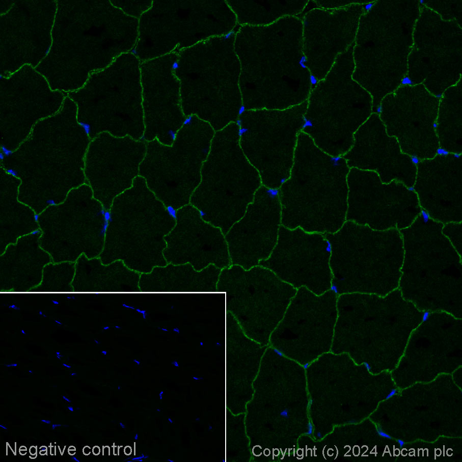 Immunohistochemistry (Frozen sections) - Alexa Fluor® 488 Anti-Dysferlin antibody [JAI-1-49-3] (AB317596), expandable thumbnail