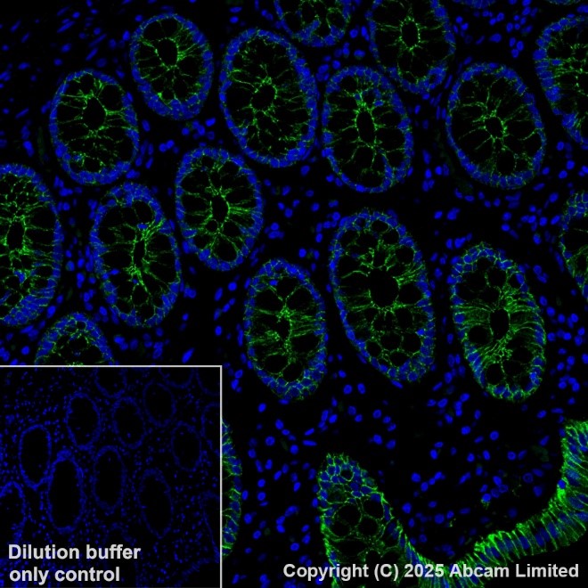 Anti-E Cadherin Alexa Fluor® 488 antibody [EP700Y] (ab185013) IgG