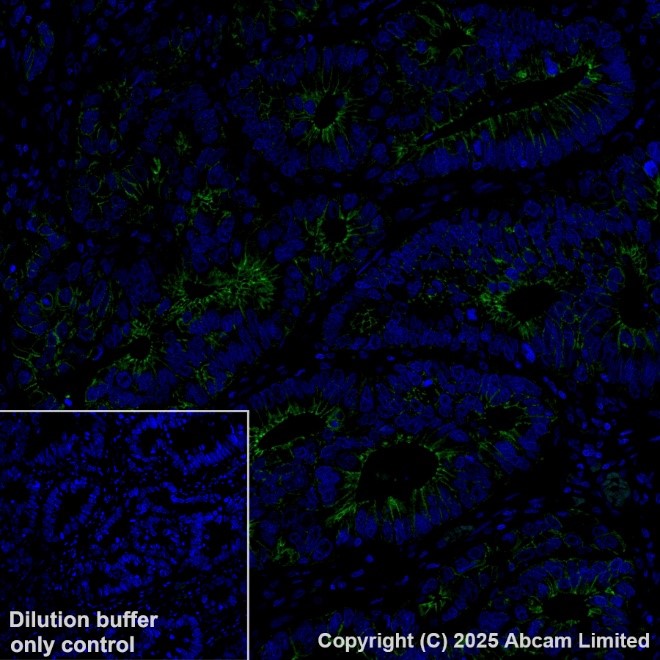 Immunohistochemistry (Formalin/PFA-fixed paraffin-embedded sections) - Alexa Fluor® 488 Anti-E Cadherin antibody [EP700Y] - Intercellular Junction Marker (AB185013)